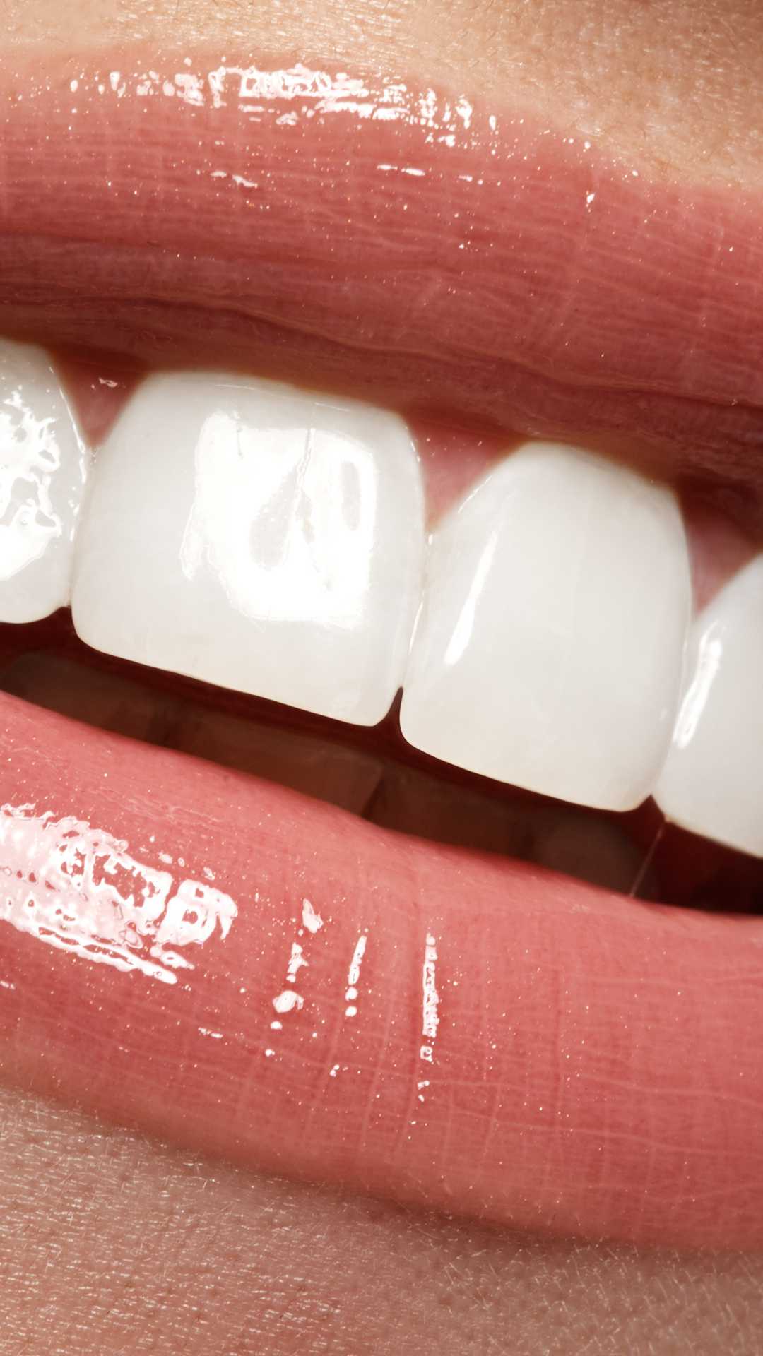 Cosmetic Dentist in Adelaide