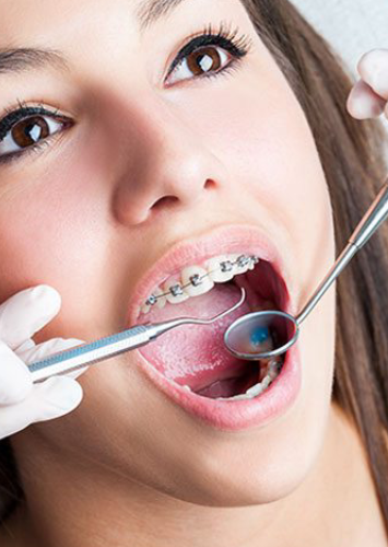 Modern orthodontics treatments at Adelaide Dental Spa