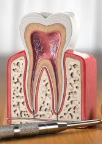 Gentle endodontic procedure at Adelaide Dental Spa