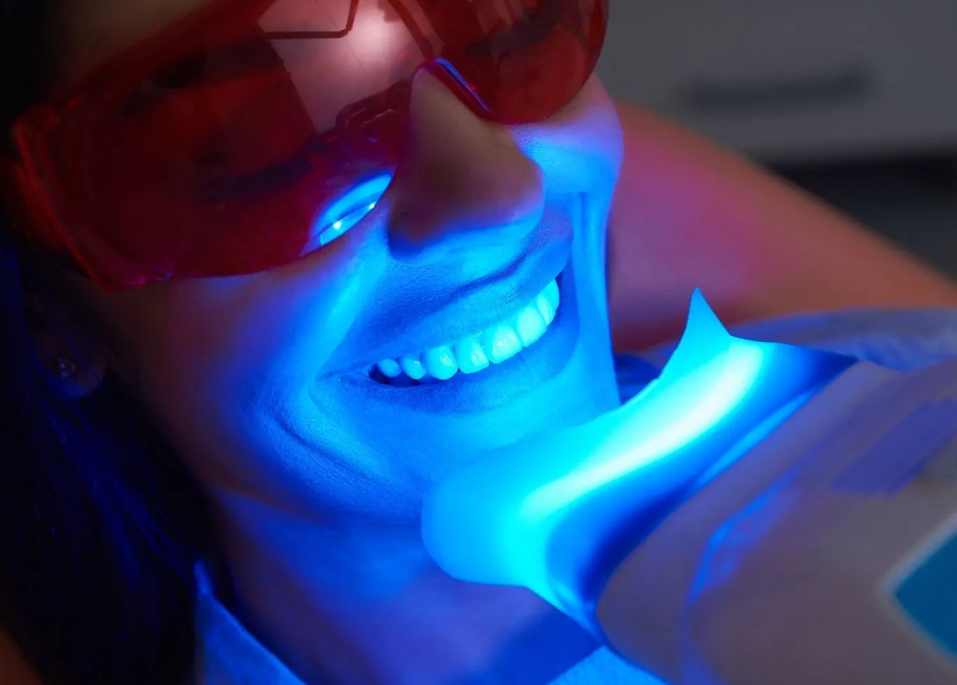 Teeth Whitening