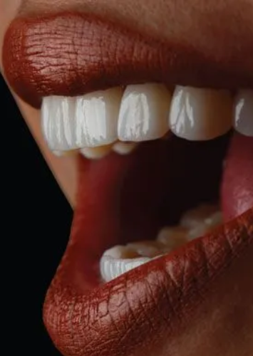 Cosmetic Dental Services