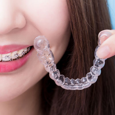 Woman wearing traditional braces and holding an invisible aligner