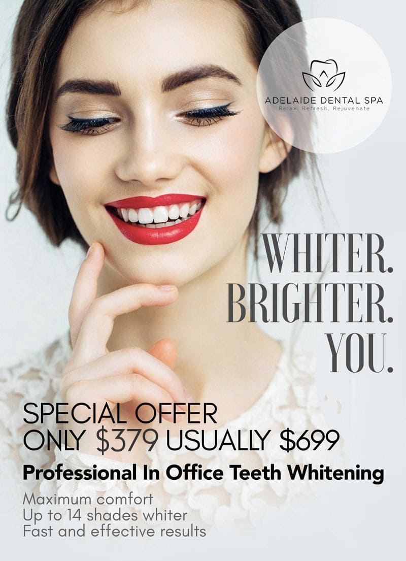 Teeth Whitening flyer