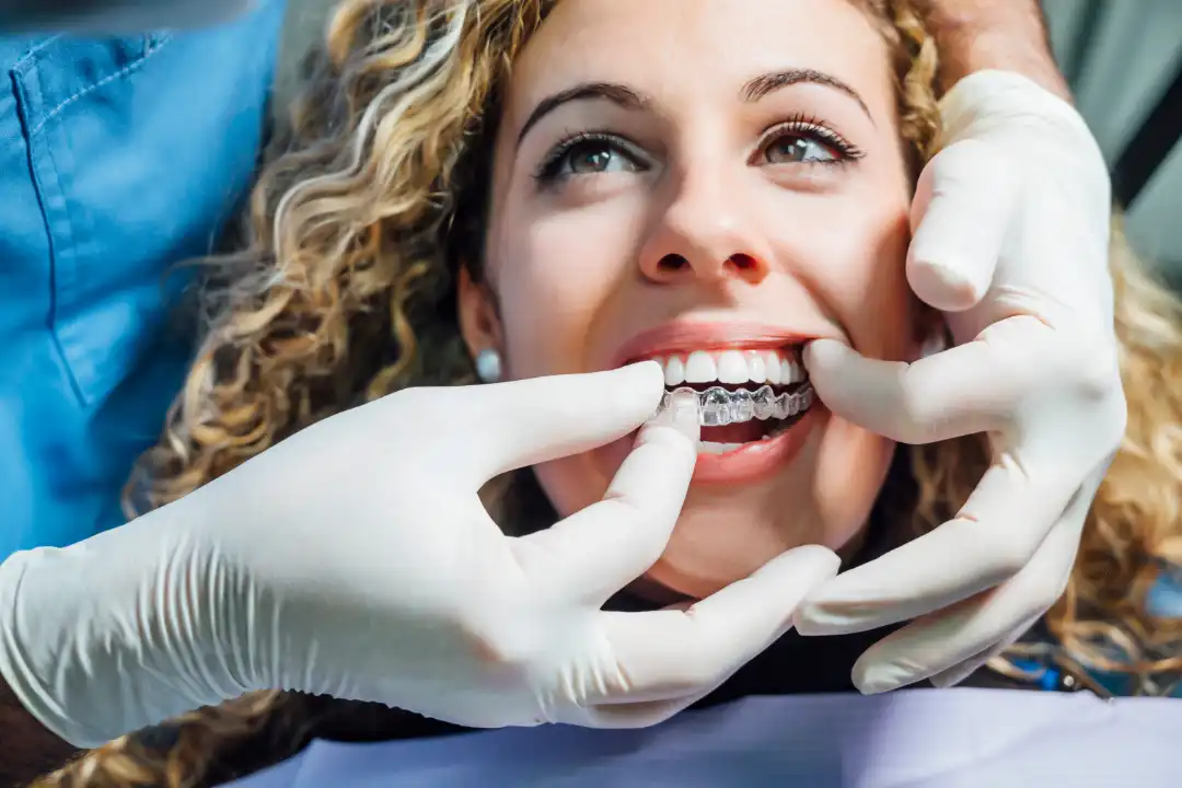 Clear Aligners Adelaide