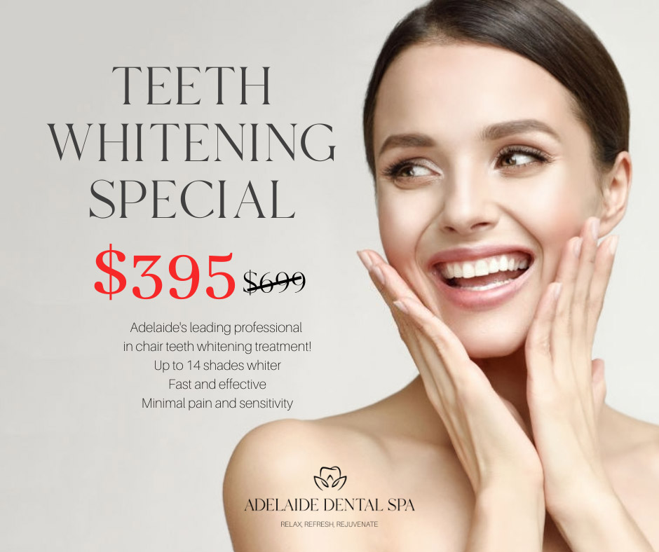 Teeth-Whitening-promo