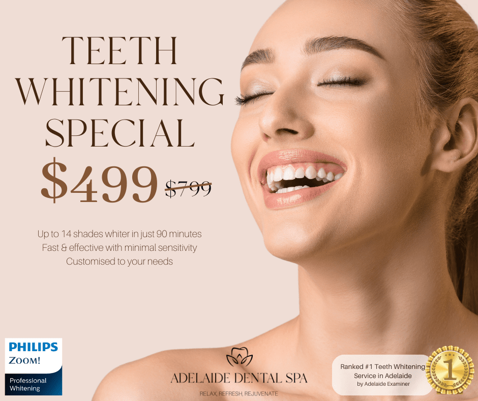 Teeth-Whitening-promo